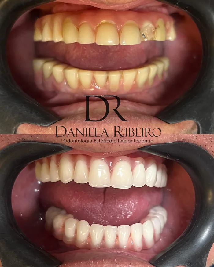 Antes e depois — Dra. Daniela Ribeiro 1