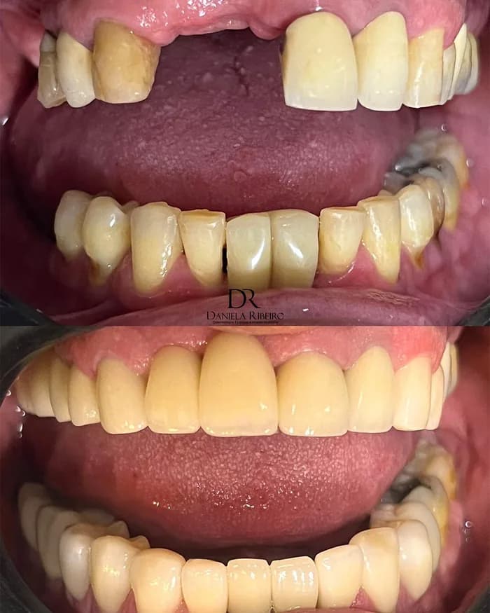 Antes e depois — Dra. Daniela Ribeiro 4
