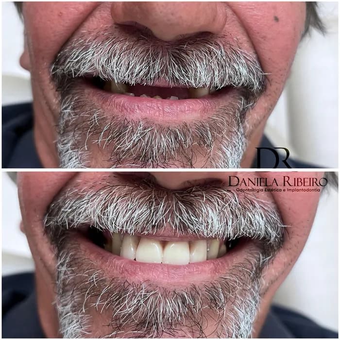 Antes e depois — Dra. Daniela Ribeiro 6