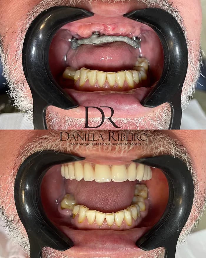 Antes e depois — Dra. Daniela Ribeiro 7